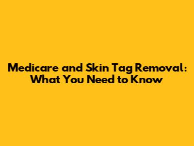 Medicare and Skin Tag Removal: What You Need to Know